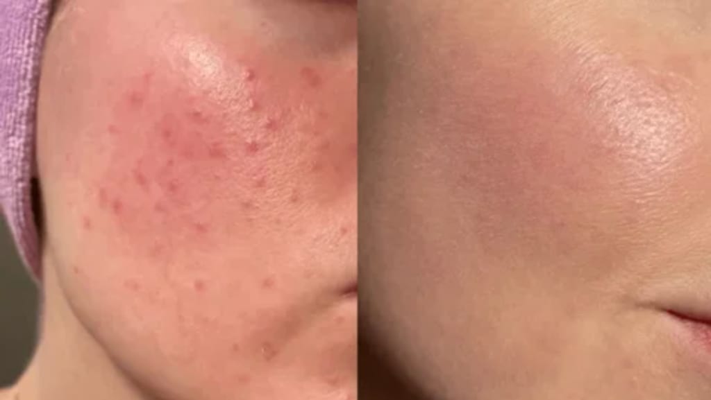 Vilessa Exfoliating Gel
