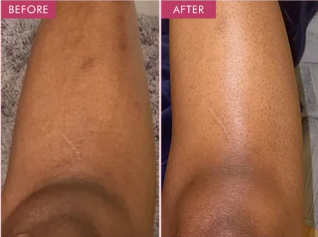 Vilessa Exfoliating Gel