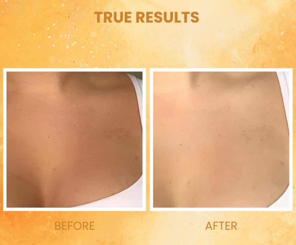 Vilessa Exfoliating Gel