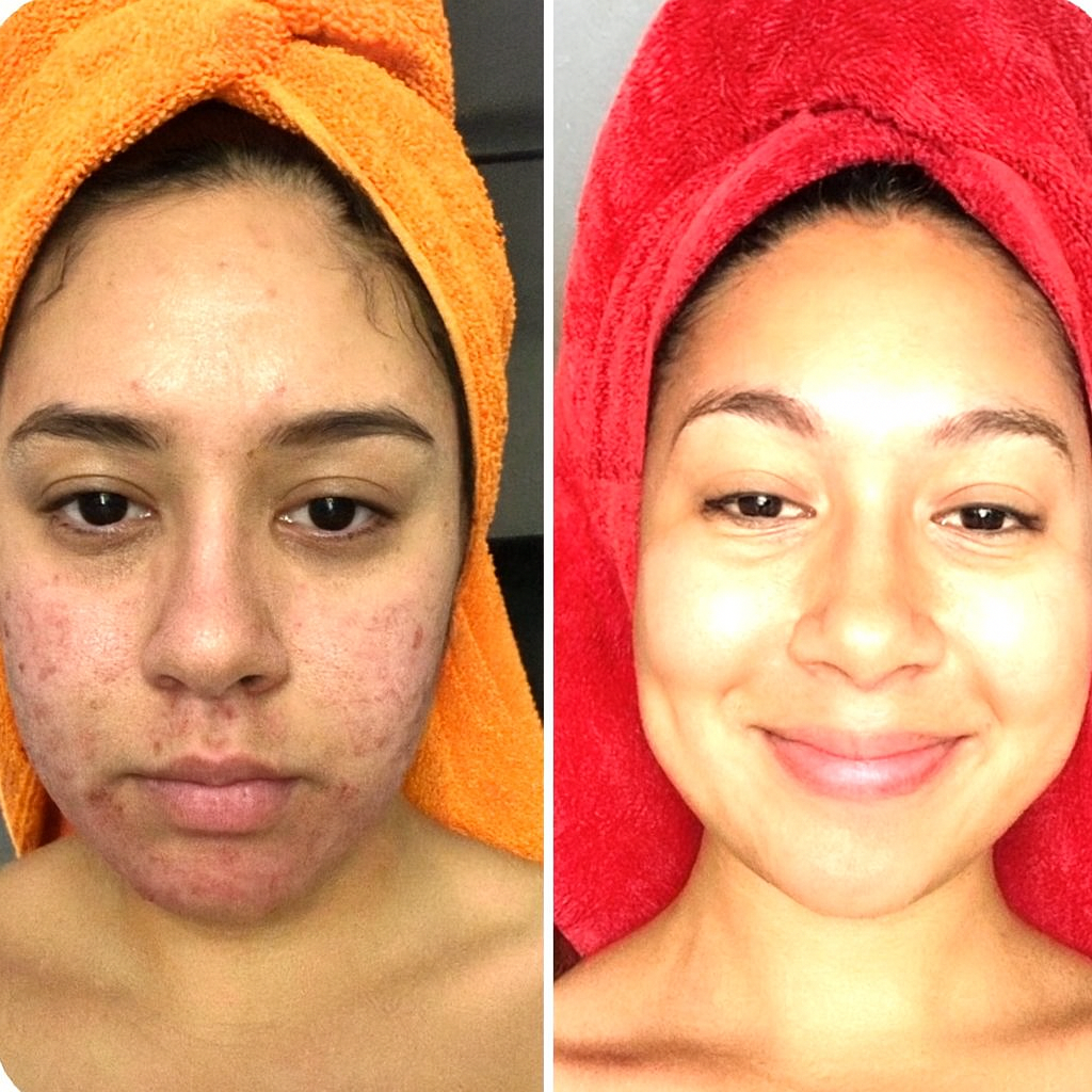 GlowRice Exfoliating Serum - Vilessa