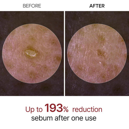 GlowRice Exfoliating Serum - Vilessa